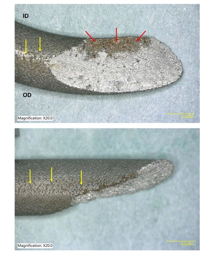Digital microscope images of the wire fracture surface as viewed looking down on the top of the coil (top) and from the ID of the coil (bottom). The red arrows point to a thumbnail shaped stain on the fracture surface. The yellow arrows point to openings on the spring wire surface.(Credit: NTSB)